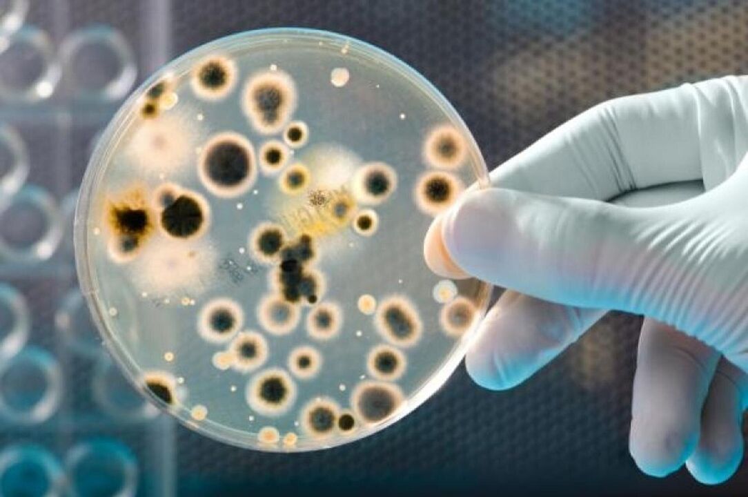 бактерии, причиняващи инфекциозен простатит